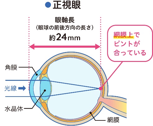 正視眼